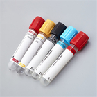 metropolitana degli ED del campione di sangue dei tubi K3 della raccolta del sangue di vuoto 1-10ml