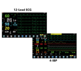 Analizzatore anestetico portatile TFT 15,6 dell'ossigeno dei dispositivi di sorveglianza» LCD